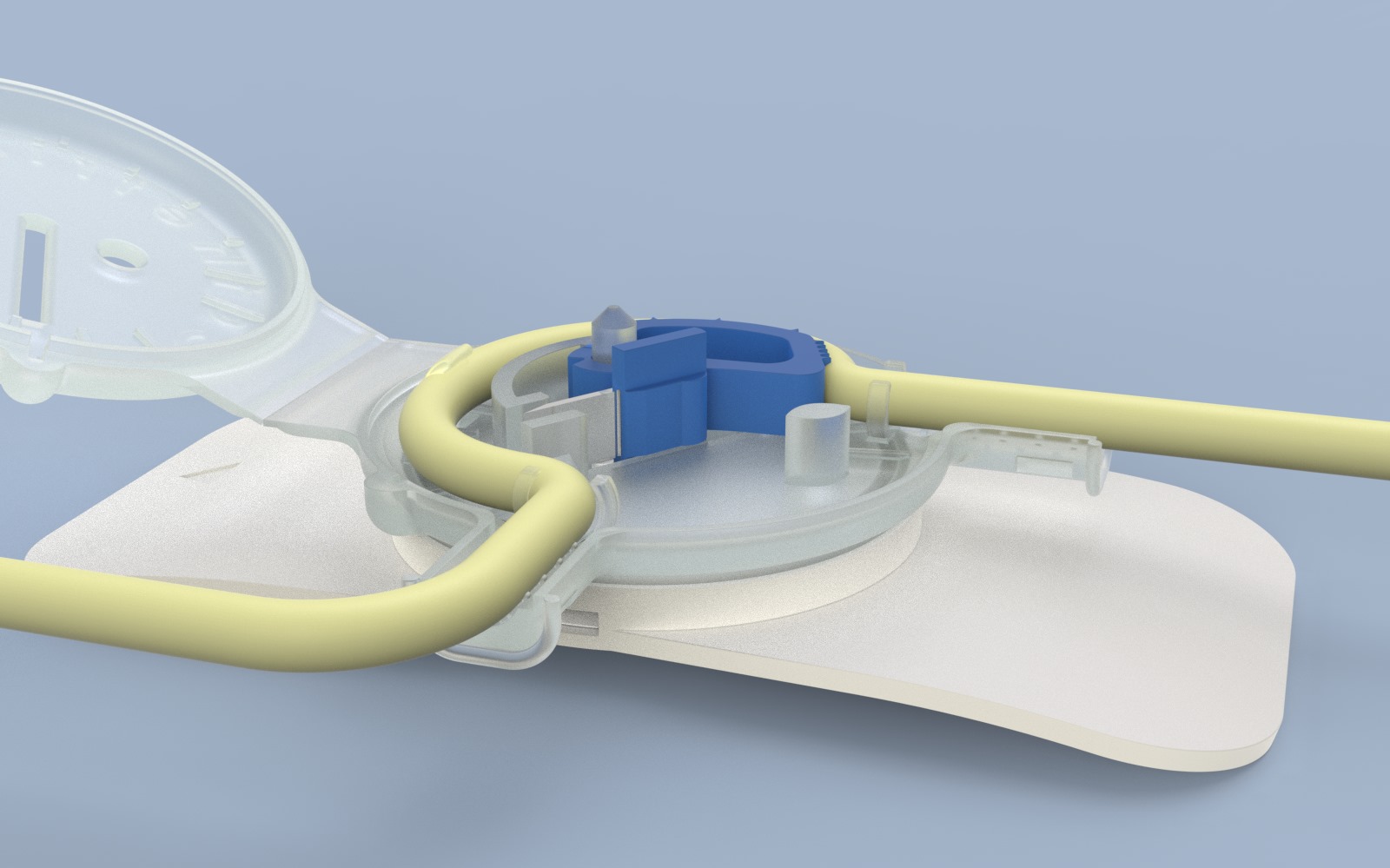 Read more about the article Cathetrix enters Canadian urinary care market, partners with K77 to explore market opportunities